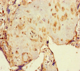 Immunohistochemistry of paraffin-embedded human placenta tissue using NR1H3 Antibody at dilution of 1:100Rabbit anti-Human NR1H3 Polyclonal Antibody