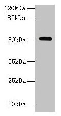 Western blot  | All lanes: NR1H3 antibody at 6µg/ml + Mouse liver tissue  | Secondary  | Goat polyclonal to rabbit IgG at 1/10000 dilution  | Predicted band size: 51, 44, 46 kDa  | Observed band size: 51 kDaRabbit anti-Human NR1H3 Polyclonal Antibody