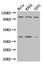 Western Blot  | Positive WB detected in: Hela whole cell lysate, K562 whole cell lysate, U251 whole cell lysate  | All lanes: PSMD2 antibody at 3µg/ml  | Secondary  | Goat polyclonal to rabbit IgG at 1/50000 dilution  | Predicted band size: 101, 83, 86 kDa  | Observed band size: 101, 40 kDaRabbit anti-Human PSMD2 Polyclonal Antibody