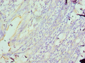 Immunohistochemistry of paraffin-embedded human colon using MAD2L1 Antibody at dilution of 1:100