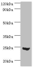 Western blot | All lanes: Mitotic spindle assembly checkpoint protein MAD2A antibody at 3μg/ml + 293T whole cell lysate | Secondary | Goat polyclonal to rabbit IgG at 1/10000 dilution | Predicted band size: 24, 11 kDa | Observed band size: 24 kDa