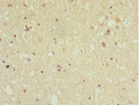 Immunohistochemistry of paraffin-embedded human brain tissue using PPP2R5C Antibody at dilution of 1:100Rabbit anti-Human PPP2R5C Polyclonal Antibody
