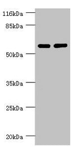 Western blot | All lanes: PPP2R5C antibody at 1.31μg/ml | Lane 1: MM231 whole cell lysate | Lane 2: K562 whole cell lysate | Secondary | Goat polyclonal to rabbit IgG at 1/10000 dilution | Predicted band size: 62, 53, 57, 63, 65 kDa | Observed band size: 62 kDaRabbit anti-Human PPP2R5C Polyclonal Antibody