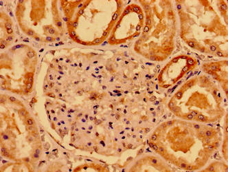 Immunohistochemistry of paraffin-embedded human kidney tissue using SMAD4 Antibody at dilution of 1:100Rabbit anti-Human SMAD4 Polyclonal Antibody