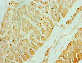 Immunohistochemistry of paraffin-embedded human heart tissue using ASAH1 Antibody at dilution of 1:100Rabbit anti-Human ASAH1 Polyclonal Antibody