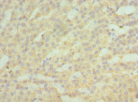 Immunohistochemistry of paraffin-embedded human kidney tissue using ASAH1 Antibody at dilution of 1:100Rabbit anti-Human ASAH1 Polyclonal Antibody
