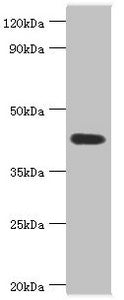 Western blot | All lanes: Acid ceramidase antibody at 6μg/ml + Mouse heart tissue | Secondary | Goat polyclonal to rabbit IgG at 1/10000 dilution | Predicted band size: 45, 47 kDa | Observed band size: 45 kDaRabbit anti-Human ASAH1 Polyclonal Antibody