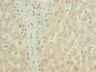 Immunohistochemistry of paraffin-embedded human liver tissue using COX17 Antibody at dilution of 1:100Rabbit anti-Human COX17 Polyclonal Antibody