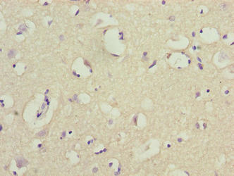 Immunohistochemistry of paraffin-embedded human brain tissue using COX17 Antibody at dilution of 1:100Rabbit anti-Human COX17 Polyclonal Antibody