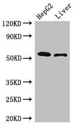 Western Blot  | Positive WB detected in: HepG2 whole cell lysate, Mouse liver tissue  | All lanes: SCARB2 antibody at 3µg/ml  | Secondary  | Goat polyclonal to rabbit IgG at 1/50000 dilution  | Predicted band size: 55, 38 kDa  | Observed band size: 55 kDaRabbit anti-Human SCARB2 Polyclonal Antibody