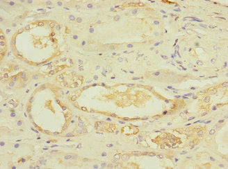 Immunohistochemistry of paraffin-embedded human kidney tissue using UBE4A Antibody at dilution of 1:100