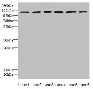 Western blot  | All lanes: UBE4A antibody at 2.24µg/ml  | Lane 1: K562 whole cell lysate  | Lane 2: MCF-7 whole cell lysate  | Lane 3: Jurkat whole cell lysate  | Lane 4: Caco-2 whole cell lysate  | Lane 5: HepG2 whole cell lysate  | Lane 6: 293T whole cell lysate  | Secondary  | Goat polyclonal to rabbit IgG at 1/10000 dilution  | Predicted band size: 123, 124 kDa  | Observed band size: 123 kDa