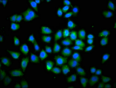 Immunofluorescence staining of Hela cells with DOCK1 Antibody at 1:66, counter-stained with DAPI. The cells were fixed in 4% formaldehyde, permeabilized using 0.2% Triton X-100 and blocked in 10% normal Goat Serum. The cells were then incubated with the antibody overnight at 4°C. The secondary antibody was Alexa Fluor 488-congugated AffiniPure Goat Anti-Rabbit IgG(H+L).Rabbit anti-Human DOCK1 Polyclonal Antibody