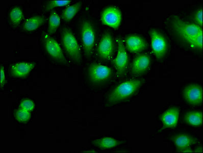 Immunofluorescence staining of A549 cells with DOCK1 Antibody at 1:66, counter-stained with DAPI. The cells were fixed in 4% formaldehyde, permeabilized using 0.2% Triton X-100 and blocked in 10% normal Goat Serum. The cells were then incubated with the antibody overnight at 4°C. The secondary antibody was Alexa Fluor 488-congugated AffiniPure Goat Anti-Rabbit IgG(H+L).Rabbit anti-Human DOCK1 Polyclonal Antibody