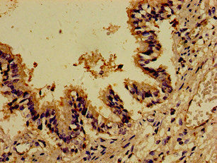 Immunohistochemistry of paraffin-embedded human lung tissue using the antibody at dilution of 1:100Rabbit anti-Human DOCK1 Polyclonal Antibody