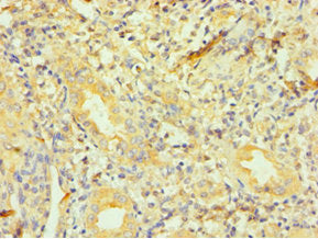 Immunohistochemistry of paraffin-embedded human kidney tissue using DCTN1 Antibody at dilution of 1:100Rabbit anti-Human DCTN1 Polyclonal Antibody