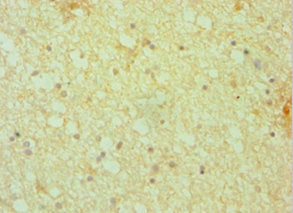 Immunohistochemistry of paraffin-embedded human brain tissue using DCTN1 Antibody at dilution of 1:100Rabbit anti-Human DCTN1 Polyclonal Antibody