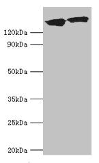 Western blot  | All lanes: DCTN1 antibody at 20µg/ml  | Lane 1: Mouse brain tissue  | Lane 2: Jurkat whole cell lysate  | Secondary  | Goat polyclonal to rabbit IgG at 1/10000 dilution  | Predicted band size: 142, 128, 137, 139, 127, 141 kDa  | Observed band size: 142 kDaRabbit anti-Human DCTN1 Polyclonal Antibody