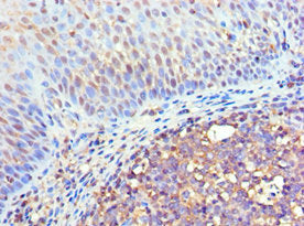 Immunohistochemistry of paraffin-embedded human tonsil tissue using FLOT2 Antibody at dilution of 1:100Rabbit anti-Human FLOT2 Polyclonal Antibody
