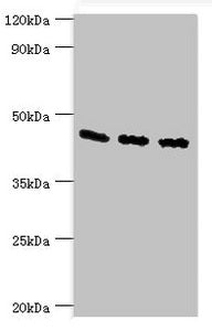 Western blot | All lanes: Flotillin-2 antibody at 4μg/ml | Lane 1: A549 whole cell lysate | Lane 2: Hela whole cell lysate | Lane 3: Rat brain tissue | Secondary | Goat polyclonal to rabbit IgG at 1/10000 dilution | Predicted band size: 47 kDa | Observed band size: 47 kDaRabbit anti-Human FLOT2 Polyclonal Antibody