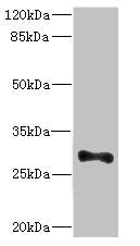 Western blot | All lanes: ICAM4 antibody at 4.98μg/ml + Mouse brain tissue | Secondary | Goat polyclonal to rabbit IgG at 1/10000 dilution | Predicted band size: 30, 26 kDa | Observed band size: 30 kDaRabbit anti-Human ICAM4 Polyclonal Antibody