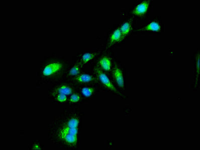 Immunofluorescence staining of Hela cells with TNIP1 Antibody at 1:100, counter-stained with DAPI. The cells were fixed in 4% formaldehyde, permeabilized using 0.2% Triton X-100 and blocked in 10% normal Goat Serum. The cells were then incubated with the antibody overnight at 4°C. The secondary antibody was Alexa Fluor 488-congugated AffiniPure Goat Anti-Rabbit IgG(H+L).Rabbit anti-Human TNIP1 Polyclonal Antibody