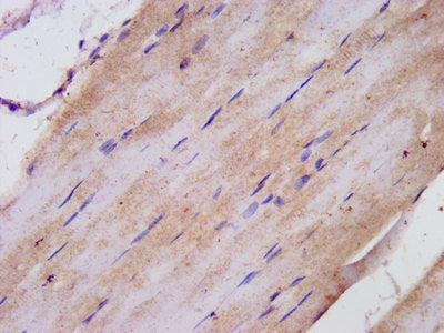IHC image of TNIP1 Antibody diluted at 1:300 and staining in paraffin-embedded human skeletal muscle tissue performed on a Leica BondTM system.Rabbit anti-Human TNIP1 Polyclonal Antibody