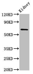 Western Blot | Positive WB detected in: Rat kidney tissue | All lanes: TNIP1 antibody at 7μg/ml | Secondary | Goat polyclonal to rabbit IgG at 1/50000 dilution | Predicted band size: 72, 67, 65, 63, 62 kDa | Observed band size: 72 kDaRabbit anti-Human TNIP1 Polyclonal Antibody