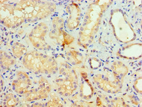Immunohistochemistry of paraffin-embedded human kidney tissue using SETDB1 Antibody at dilution of 1:100Rabbit anti-Human SETDB1 Polyclonal Antibody