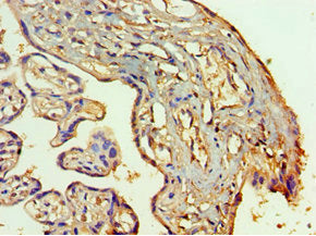 Immunohistochemistry of paraffin-embedded human placenta tissue using SETDB1 Antibody at dilution of 1:100Rabbit anti-Human SETDB1 Polyclonal Antibody