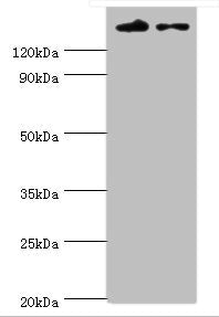 Western blot | All lanes: SETDB1 antibody at 5μg/ml | Lane 1: Rat adrenal gland tissue | Lane 2: 293T whole cell lysate | Secondary | Goat polyclonal to rabbit IgG at 1/10000 dilution | Predicted band size: 144, 45 kDa | Observed band size: 144 kDaRabbit anti-Human SETDB1 Polyclonal Antibody
