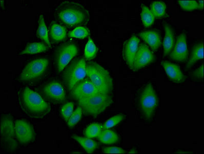 Immunofluorescence staining of A549 cells with PAFAH1B3 Antibody at 1:200, counter-stained with DAPI. The cells were fixed in 4% formaldehyde, permeabilized using 0.2% Triton X-100 and blocked in 10% normal Goat Serum. The cells were then incubated with the antibody overnight at 4°C. The secondary antibody was Alexa Fluor 488-congugated AffiniPure Goat Anti-Rabbit IgG(H+L).Rabbit anti-Human PAFAH1B3 Polyclonal Antibody