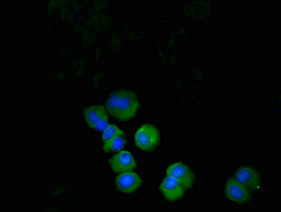 Immunofluorescent analysis of MCF-7 cells using PDCD1 Antibody at dilution of 1: 100 and Alexa Fluor 488-congugated AffiniPure Goat Anti-Rabbit IgG(H+L)Rabbit anti-Human PDCD1 Polyclonal Antibody