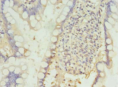 Immunohistochemistry of paraffin-embedded human small intestine tissue using PDCD1 Antibody at dilution of 1:100Rabbit anti-Human PDCD1 Polyclonal Antibody