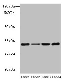 Western blot  | All lanes: PDCD1 antibody at 6µg/ml  | Lane 1: 293T whole cell lysate  | Lane 2: Hela whole cell lysate  | Lane 3: K562 whole cell lysate  | Lane 4: Mouse stomach tissue  | Secondary  | Goat polyclonal to rabbit IgG at 1/10000 dilution  | Predicted band size: 32 kDa  | Observed band size: 32 kDaRabbit anti-Human PDCD1 Polyclonal Antibody
