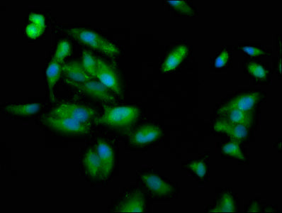 Immunofluorescence staining of Hela cells with PLEC Antibody at 1:100, counter-stained with DAPI. The cells were fixed in 4% formaldehyde, permeabilized using 0.2% Triton X-100 and blocked in 10% normal Goat Serum. The cells were then incubated with the antibody overnight at 4°C. The secondary antibody was Alexa Fluor 488-congugated AffiniPure Goat Anti-Rabbit IgG(H+L).Rabbit anti-Human PLEC Polyclonal Antibody