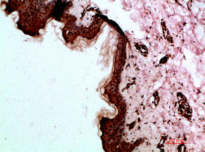 Immunohistochemical analysis of paraffin-embedded human-skin, antibody was diluted at 1:200Rabbit anti-Human DSG1 Polyclonal Antibody