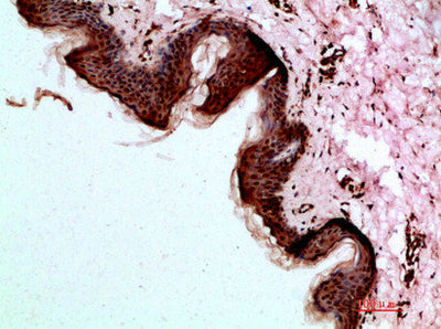 Immunohistochemical analysis of paraffin-embedded human-skin, antibody was diluted at 1:200Rabbit anti-Human DSG1 Polyclonal Antibody