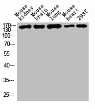 Western blot analysis of Mouse kidney tissue, Mouse brain tissue, Mouse lung tissue, Mouse heart tissue, 293T whole cell lysate, antibody was diluted at 1000. Secondary antibody was diluted at 1:20000Rabbit anti-Human DSG1 Polyclonal Antibody