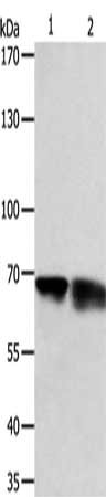 Gel: 10%SDS-PAGE, Lysate: 50 μg, Lane 1-2: NIH/3T3 cells, human fetal kidney tissue, Primary antibody: PSMD3 Antibody(PSMD3 Antibody) at dilution 1/300, Secondary antibody: Goat anti rabbit IgG at 1/8000 dilution, Exposure time: 1 minute
