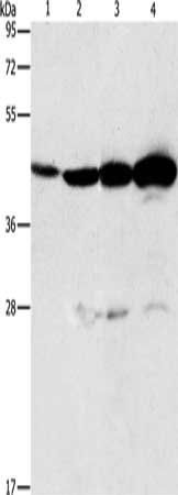 Gel: 12%SDS-PAGE, Lysate: 40 μg, Lane 1-4: Mouse thymus tissue, A549 cells, Lovo cells, K562 cells, Primary antibody: APOBEC3D Antibody(APOBEC3D Antibody) at dilution 1/580, Secondary antibody: Goat anti rabbit IgG at 1/8000 dilution, Exposure time: 30 secondsRabbit anti-Human APOBEC3D Polyclonal Antibody