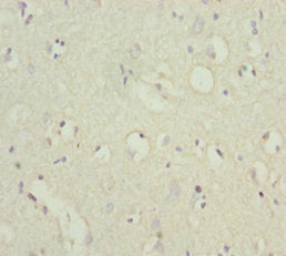 Immunohistochemistry of paraffin-embedded human brain tissue using POU4F3 Antibody at dilution of 1:100Rabbit anti-Human POU4F3 Polyclonal Antibody