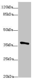 Western blot | All lanes: POU4F3antibody at 1.97μg/ml + Mouse brain tissue | Secondary | Goat polyclonal to rabbit IgG at 1/10000 dilution | Predicted band size: 37 kDa | Observed band size: 37 kDaRabbit anti-Human POU4F3 Polyclonal Antibody