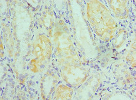 Immunohistochemistry of paraffin-embedded human kidney tissue using ELOB Antibody at dilution of 1:100Rabbit anti-Human ELOB Polyclonal Antibody