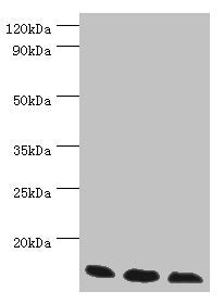Western blot | All lanes: Transcription elongation factor B polypeptide 2 antibody at 3μg/ml | Lane 1: k562 whole cell lysate | Lane 2: 293T whole cell lysate | Lane 3: HL60 whole cell lysate | Secondary | Goat polyclonal to rabbit IgG at 1/10000 dilution | Predicted band size: 14, 18 kDa | Observed band size: 14 kDaRabbit anti-Human ELOB Polyclonal Antibody