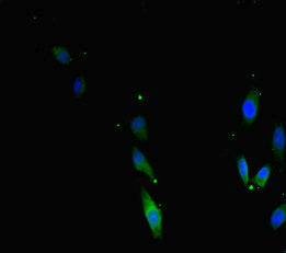 Immunofluorescent analysis of Hela cells using TERF2 Antibody at dilution of 1:100 and Alexa Fluor 488-congugated AffiniPure Goat Anti-Rabbit IgG(H+L)Rabbit anti-Human TERF2 Polyclonal Antibody