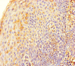 Immunohistochemistry of paraffin-embedded human tonsil tissue using TERF2 Antibody at dilution of 1:100Rabbit anti-Human TERF2 Polyclonal Antibody