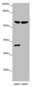 Western blot | All lanes: TERF2 antibody at 14 μg/ml | Lane 1: Mouse thymus tissue | Lane 2: MCF-7 whole cell lysate | Secondary | Goat polyclonal to rabbit IgG at 1/10000 dilution | Predicted band size: 60, 33 kDa | Observed band size: 60, 31 kDaRabbit anti-Human TERF2 Polyclonal Antibody