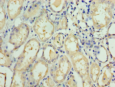 Immunohistochemistry of paraffin-embedded human kidney tissue using the antibody at dilution of 1:100Rabbit anti-Human TAF1C Polyclonal Antibody