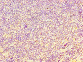 Immunohistochemistry of paraffin-embedded human tonsil tissue using CHI3L2 Antibody at dilution of 1:100Rabbit anti-Human CHI3L2 Polyclonal Antibody